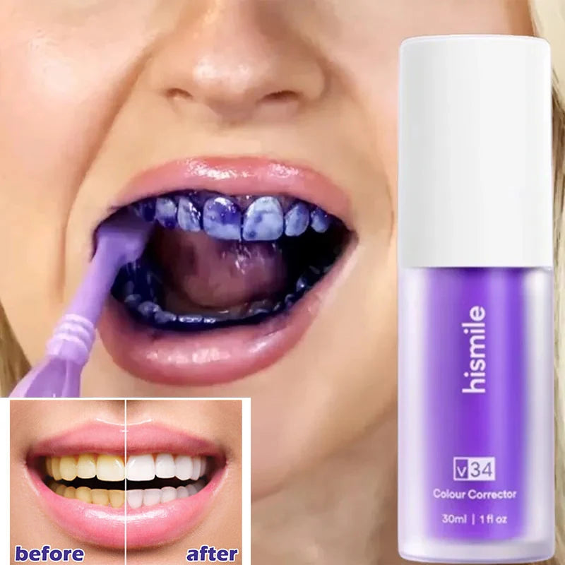 Teeth Colour Corrector Serum